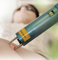 7 things to know before booking laser hair removal